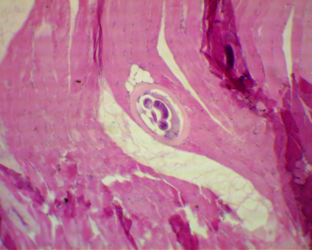 data-lemmaid="2697752">幼虫寄生 /a>于肌纤维内,一般形成囊包,囊包