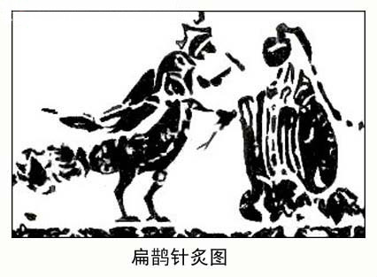 扁鹊偃侧针灸图
