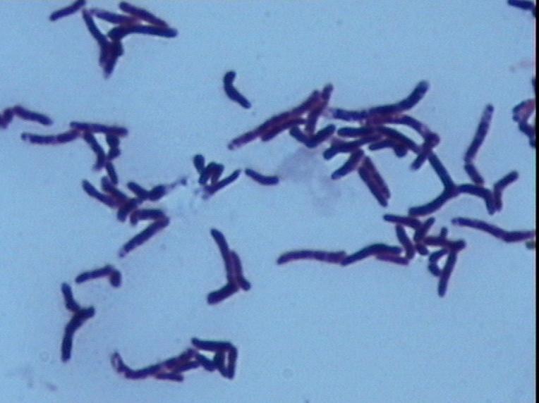 培养4天从菌落中心开始断裂,周缘菌丝继续生长并分枝.