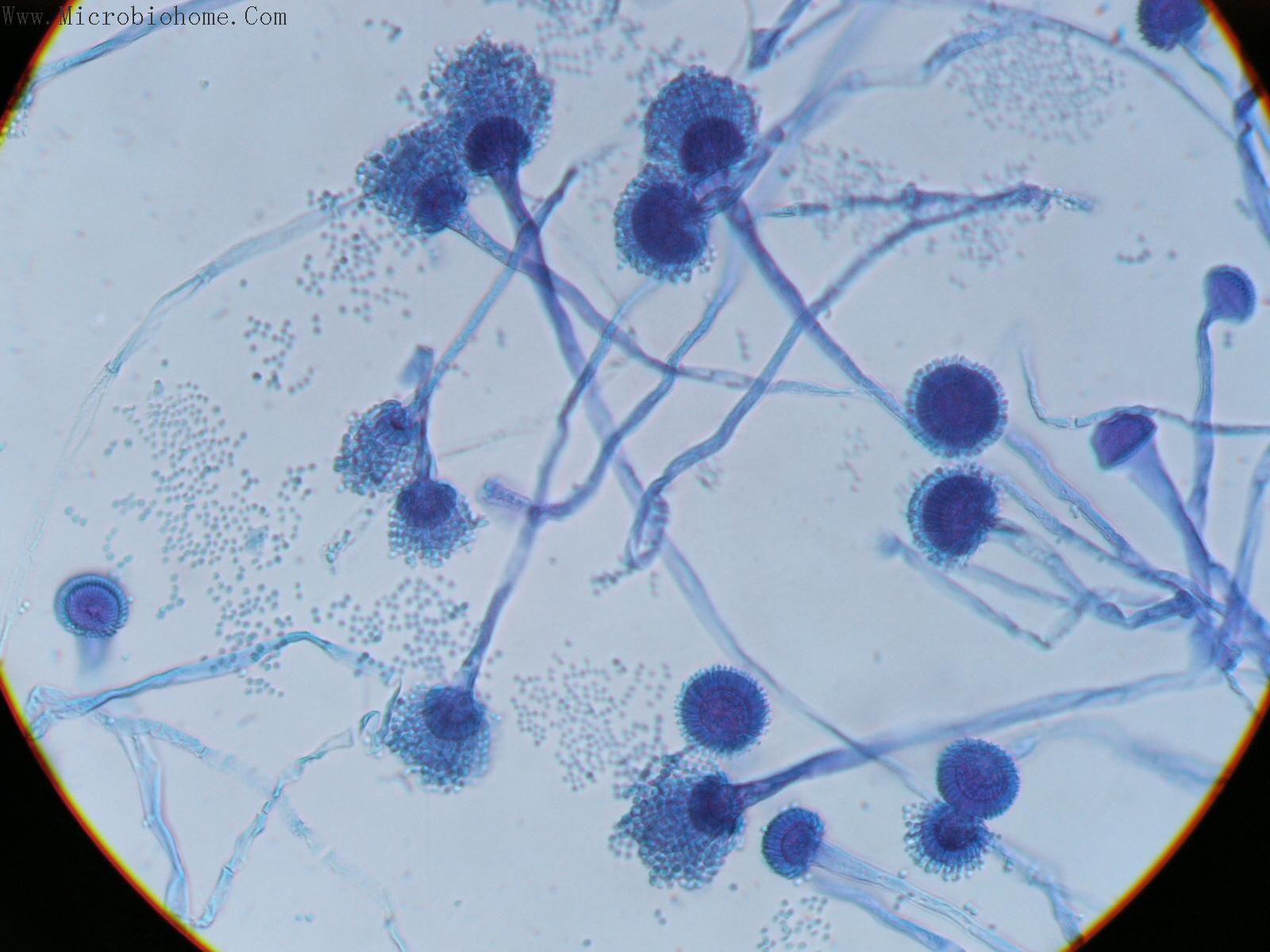 曲霉菌(aspergillus)