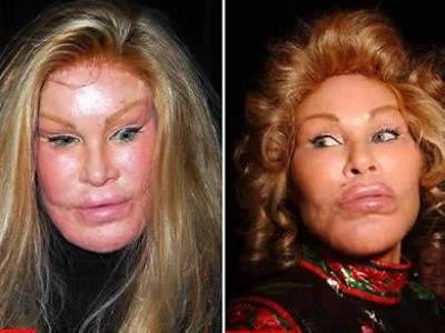 jocelyn wildenstein