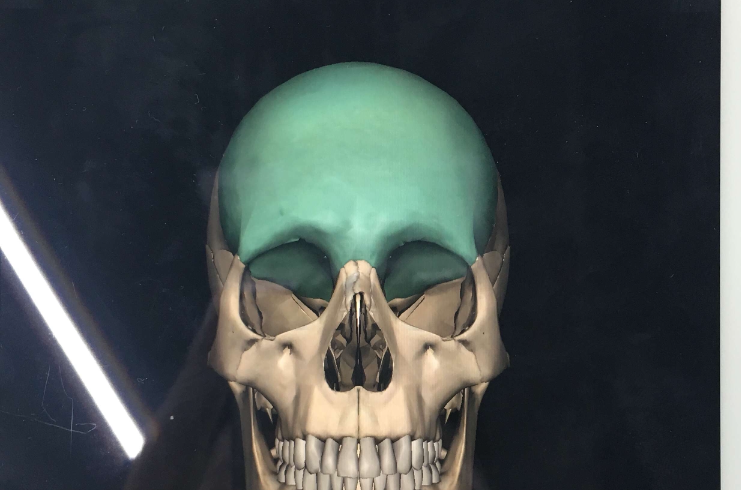 frontal bone