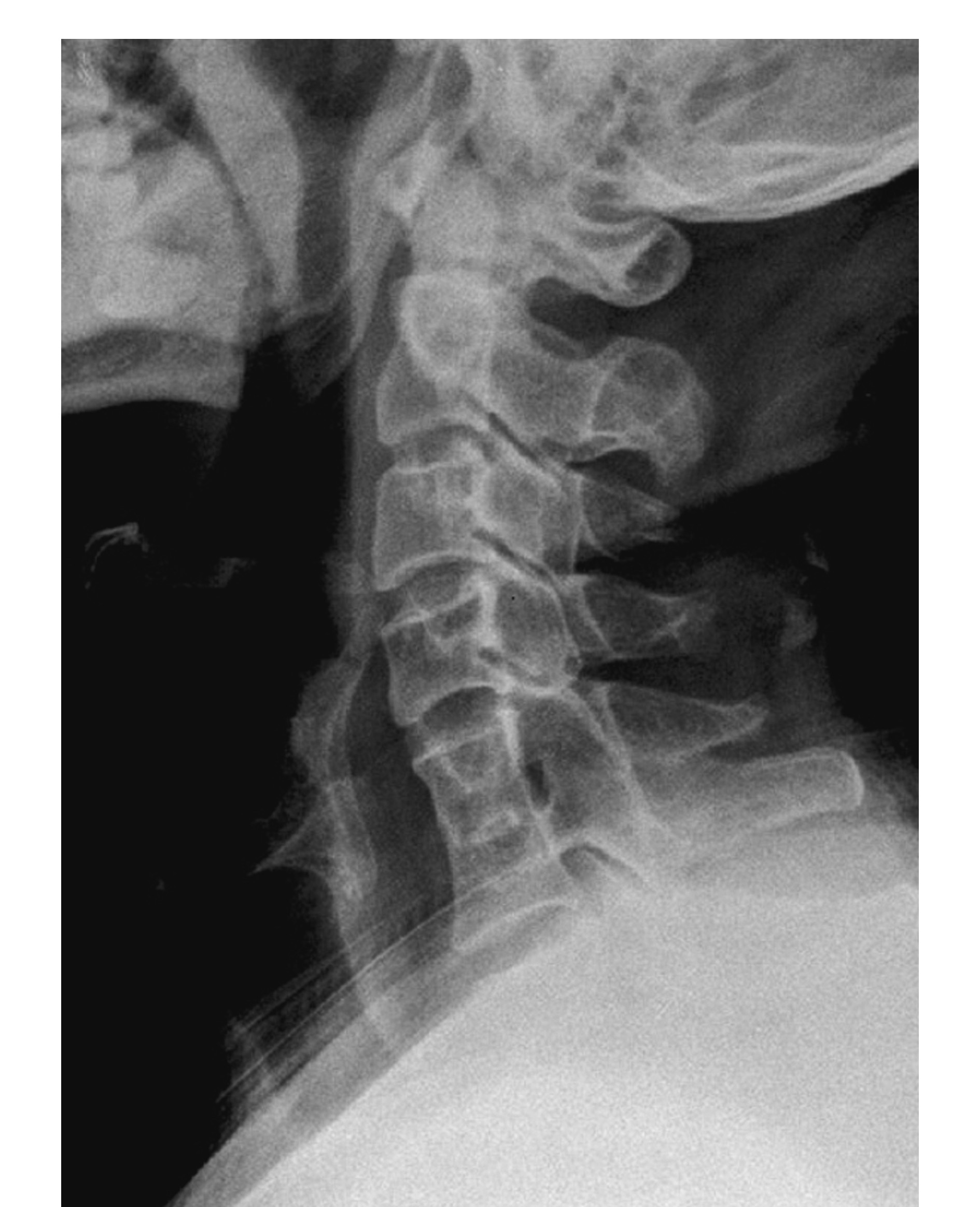  p data-id="gnfegnda8g">椎体 是椎骨负重的主要部分,呈短圆柱状