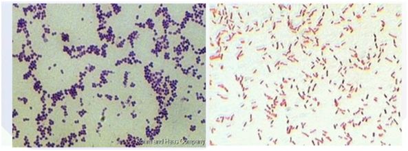  p>革兰氏染色(gram staining)是用来鉴别细菌的一种方法:这种染色法