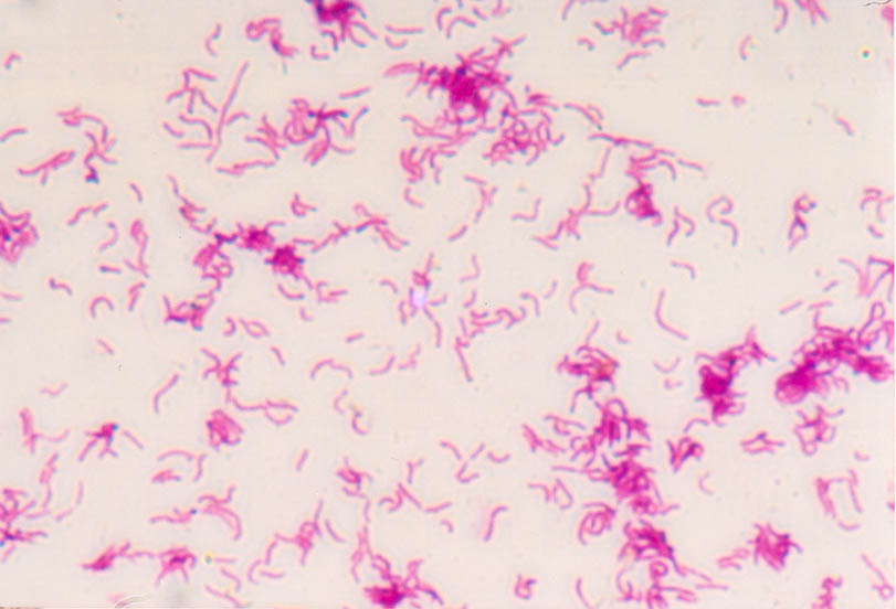 主要用于g 菌,g-球菌, a href="#" data-lemmaid="666732">螺旋体 /a>