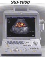 彩色超声多普勒