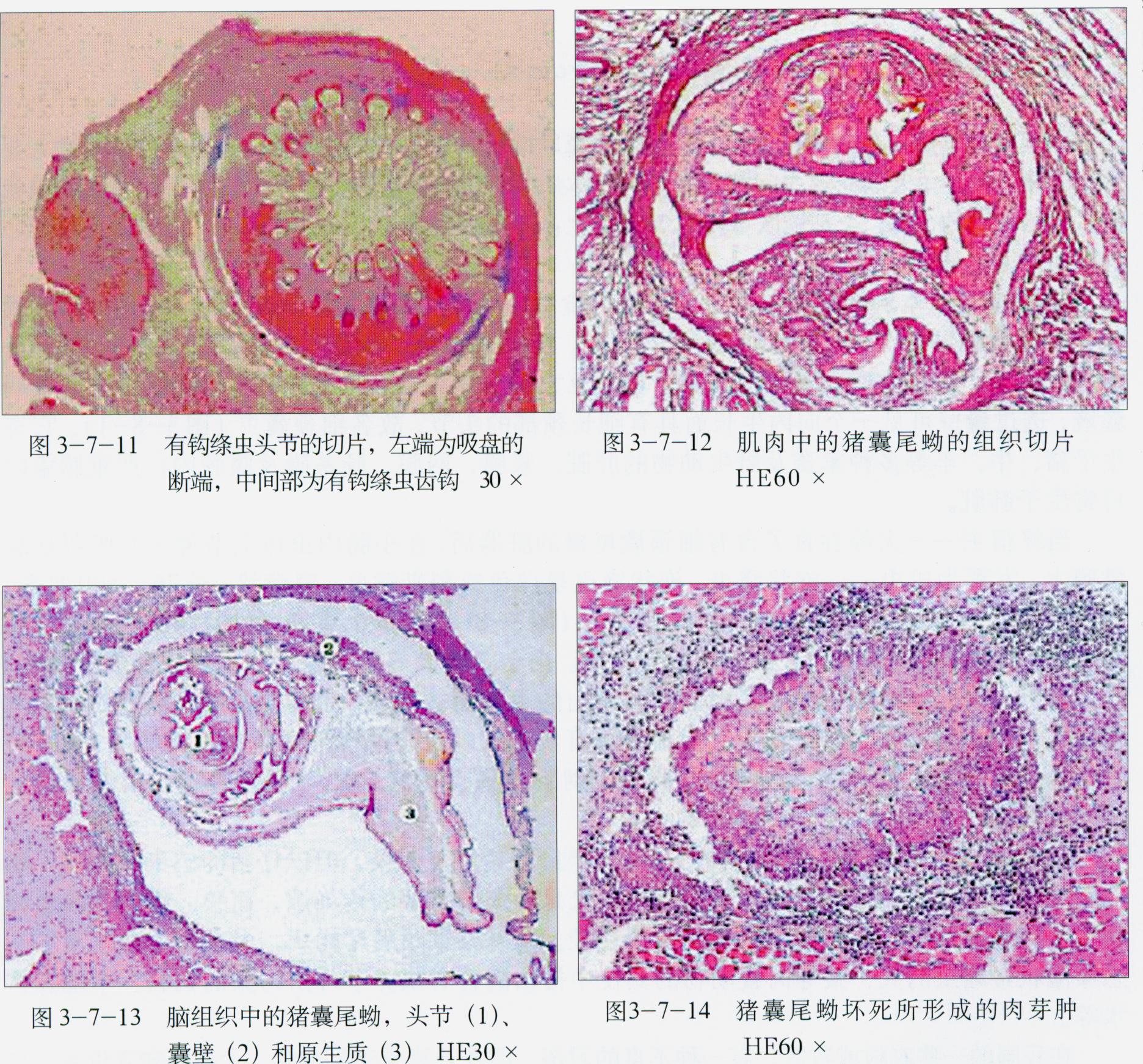  p data-id="tijx09necbry">囊尾蚴是圆叶目带科带属扁形动物猪带绦虫