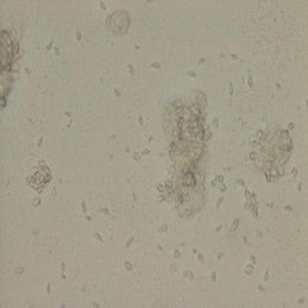 刚地弓形虫滋养体