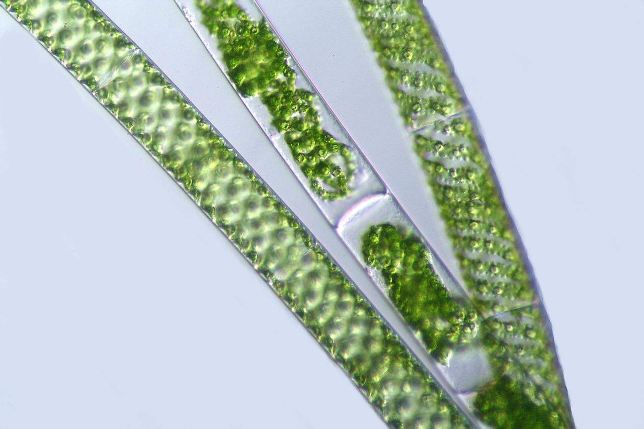  p data-id="gn6ut68eu6">冷性水绵,营养细胞宽17-20微米,长70-300