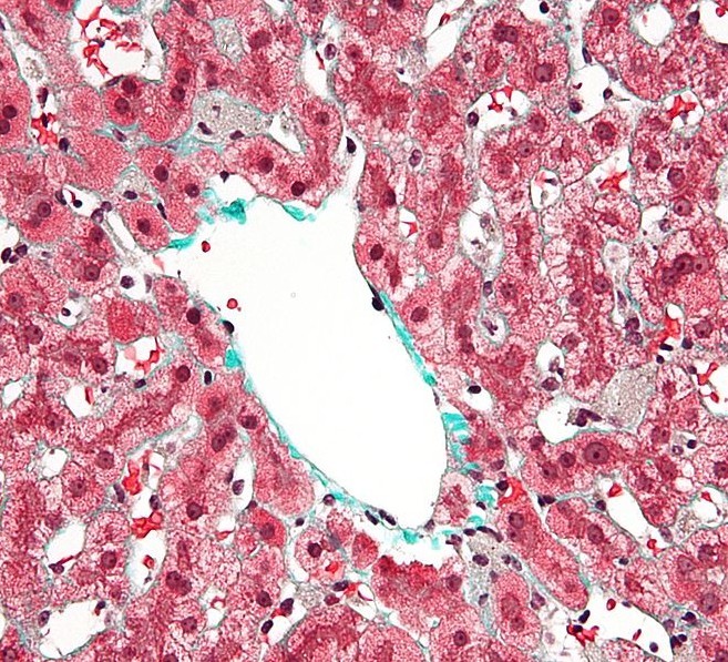 macrophages,亦称为肝 a target="_blank" href="/item/巨噬细胞