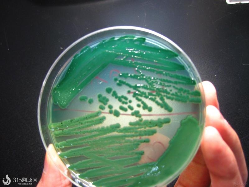 vibrio parahemolyticus