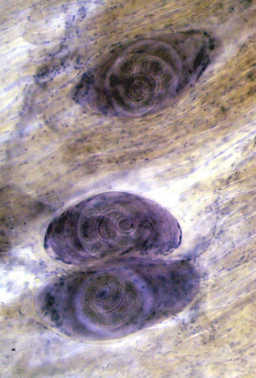  p>旋毛虫 a target="_blank" href="/item/幼虫寄生/2697752" data