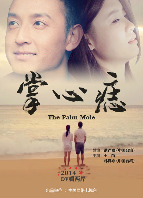 掌心痣 百度百科
