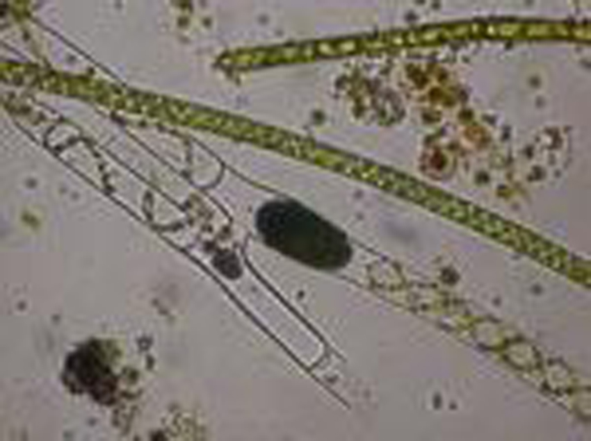 id="836992">营养细胞 /a>宽110-123微米,长140—425微米;横壁平直