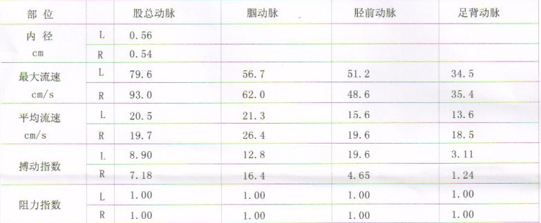 color-coded duplex sonography,经颅彩色多普勒超声检测技术)是一种