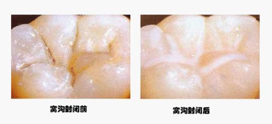  p data-id="gnvjwbv7zj">"六龄牙":是指儿童生长的第1个恒 a target=