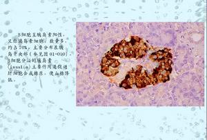  p>胰岛b细胞是 a target="_blank" href="/item/胰岛细胞/10877852"