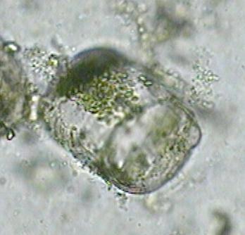  p>盒形藻属(biddulphia),中心纲,盒形藻目,盒形藻科的1属.