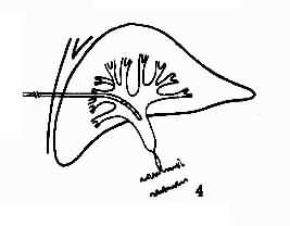  p>肝穿刺就是肝脏组织 a href="#" data-lemmaid="10877419">活检 /a