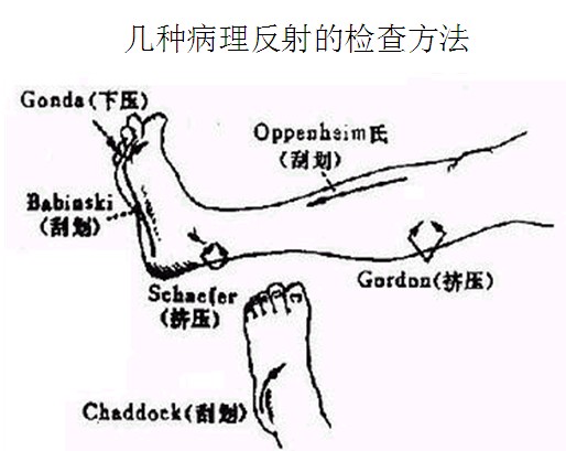  p>浅反射是刺激皮肤或黏膜所引起的反射.