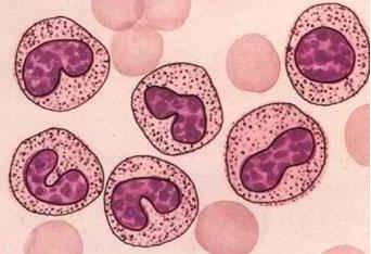 炎症、免疫与癌症扯不清理还乱关系背后：Jak/Stat-IL-6 pathway_百科TA说