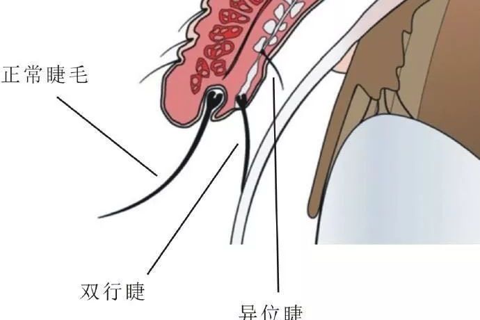  p data-id="svcvcybuacjr">双行睫为正睫毛根部后方相当于 a target=