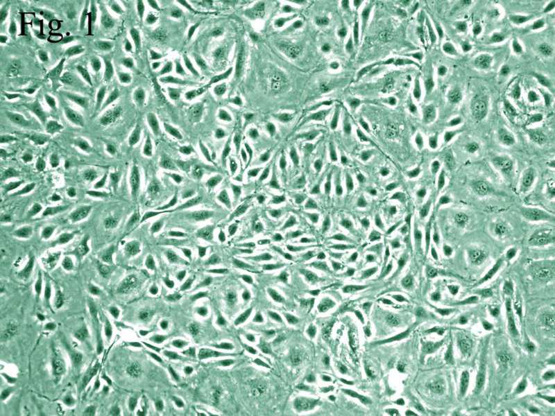  p>内皮细胞是一薄层的 a href="#" data-lemmaid="8195672">上皮细胞