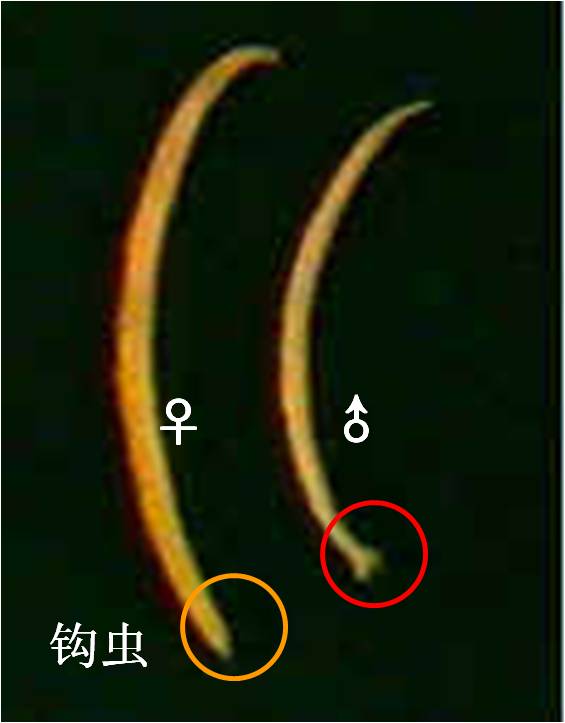  p>十二指肠钩口线虫(ancylostoma duodenale),简称为十二指肠钩虫,寄