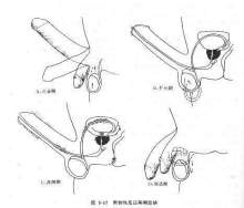 射精