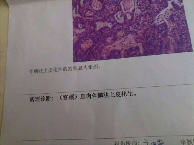 病理诊断
