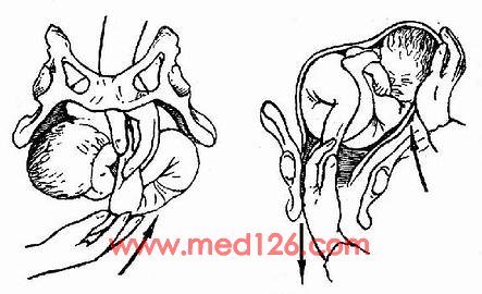 25%,称为胎儿横位.