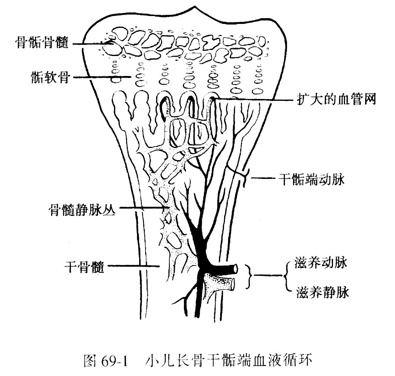 pyogenic osteomyelitis