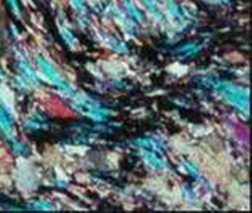  p> b>变余砂状结构 /b>(blastopsammitic texture)是变余结构的一种.