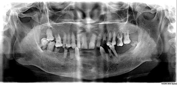口腔颌面锥形束ct