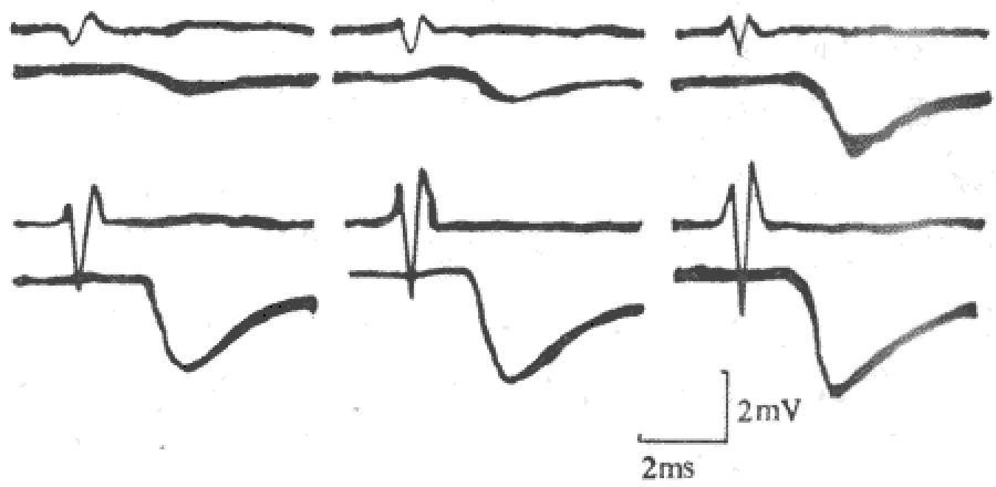  p>抑制性 a target="_blank" href="/item/突触/449914" data-lemma