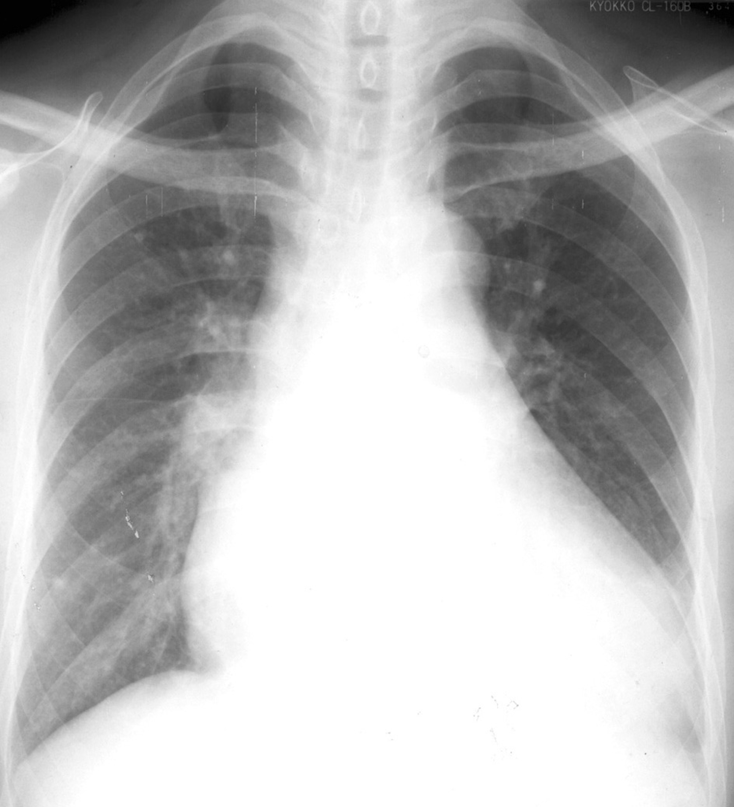 心更倾向于 a target="_blank" href="/item/横位/349169" data-lem