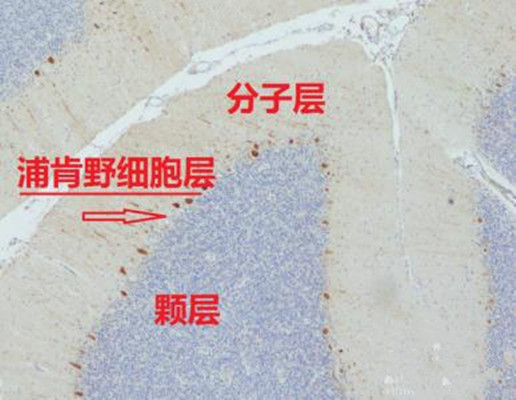  p>浦肯野细胞(purkinje cell)是从 a href="#" data-lemmaid="