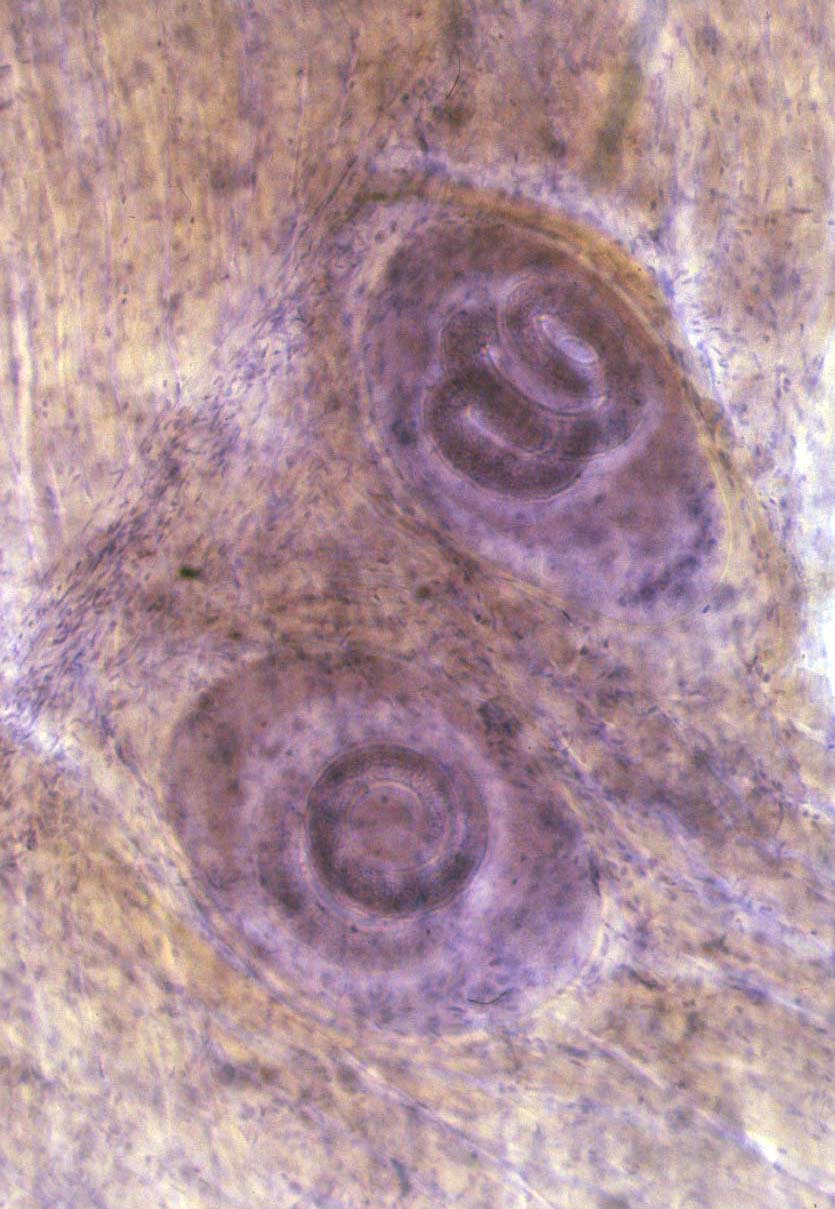  p>旋毛虫 a href="#" data-lemmaid="2697752">幼虫寄生 /a>于肌纤维