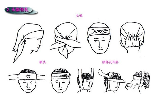 三角巾包扎法