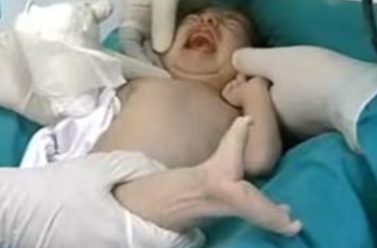 人鱼宝宝