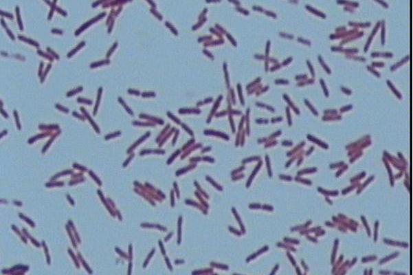 类短短芽孢杆菌