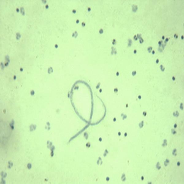 班氏吴策线虫微丝蚴