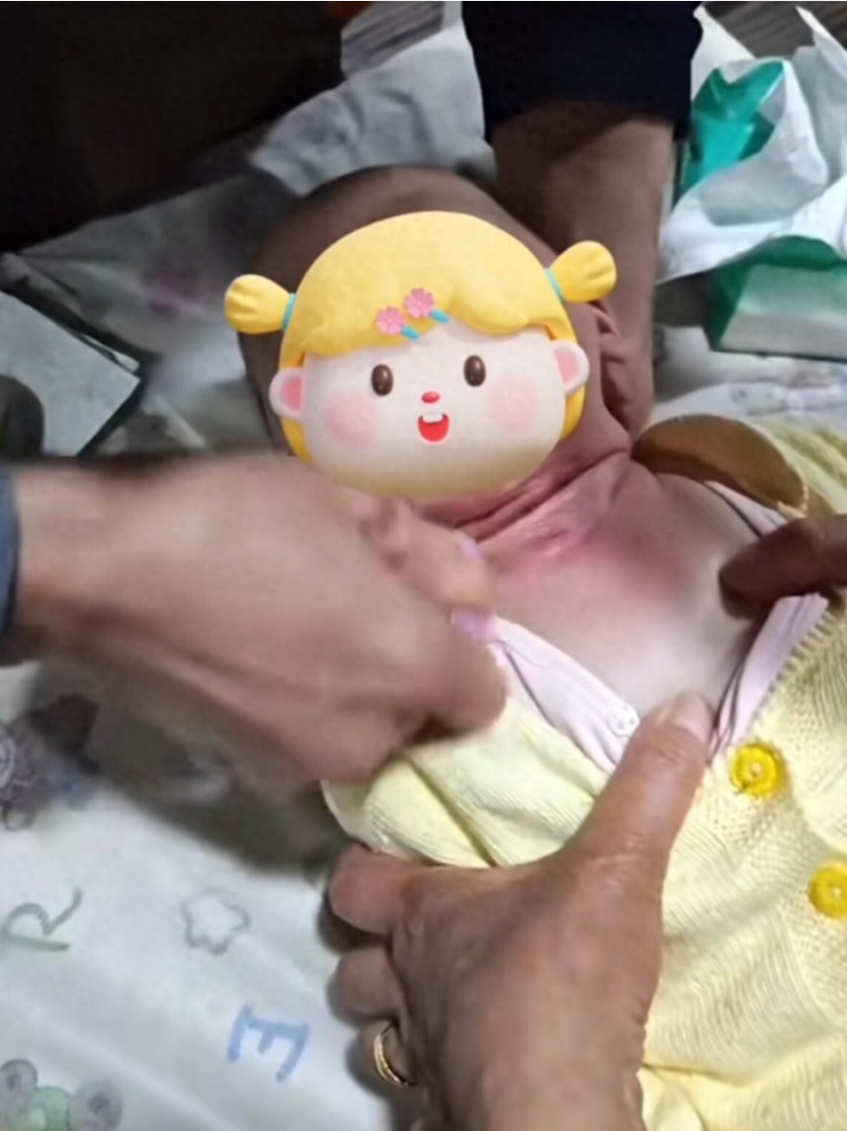 2025年成都婴儿被刮痧事件