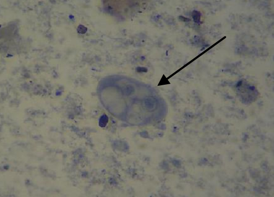 脆弱双核阿米巴