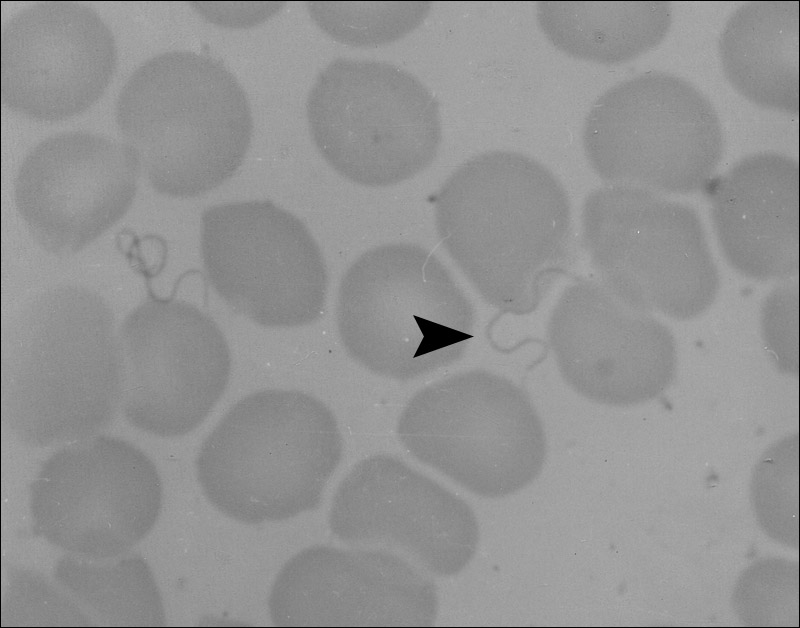 回归热疏螺旋体