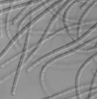  p>伪鱼腥藻又名假鱼腥藻,是一种丝状蓝藻,细胞长大于宽, 圆柱形, 宽