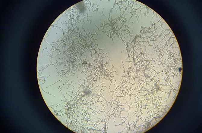 p>放线菌( i>actinomycetes /i>)是原核生物中一类能形成分枝菌丝和