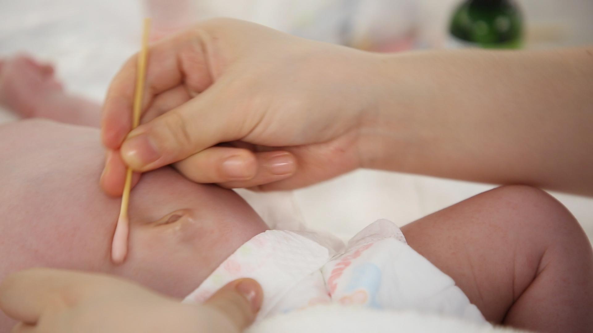 新生儿脐部护理3步走,护理不当易感染!新手家长需重视