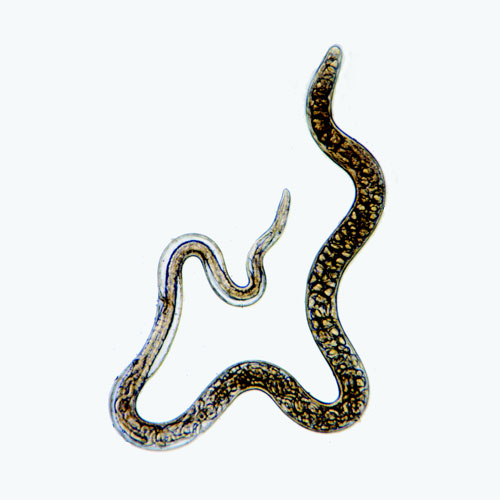  p>旋毛虫 a href="#" data-lemmaid="2697752">幼虫寄生 /a>于肌纤维