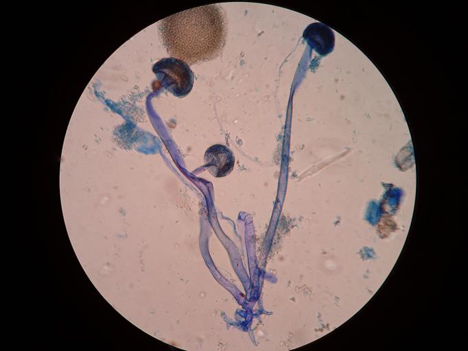  p data-id="gnviawfphr">米根霉(rhizopus oryzae went et pr.geerl.